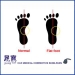 Flat Foot Shoe Insoles