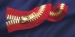 Logam Zipper