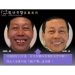 Anti Aging Dentistry
