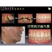 New Dental Implants