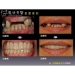 Missing Teeth