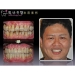 Penyakit periodontal Pengobatan