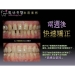 Dental Cosmetics