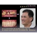 Best Dental Implants