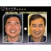 Laser Periodontal Therapy