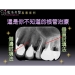 Root Canal Treatments