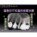 Root Canal Pengobatan