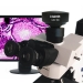 Appareil-photo de microscope de CCD